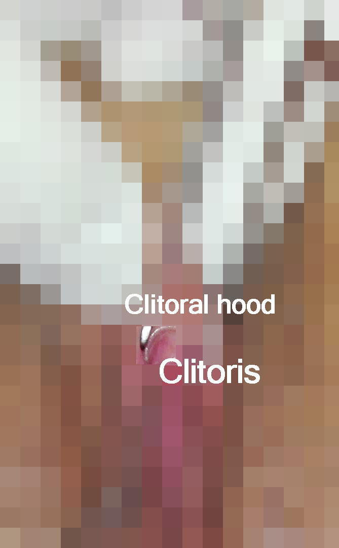 3Clitris